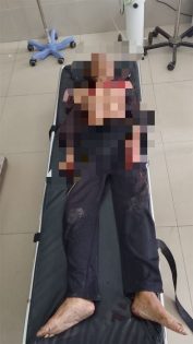 Penganiayaan di Ampah Terekam CCTV Polisi Dalami Motif